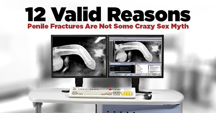 12 Valid Reasons Penile Fractures Are Not Some Crazy Sex Myth