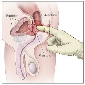 man's prostate